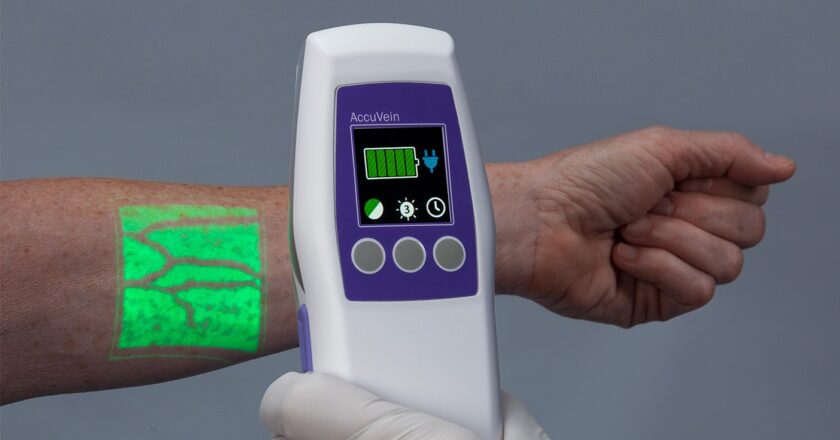 How Much Does a Vein Finder Cost